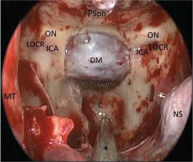 Fig. 4.