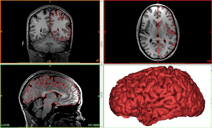 Fig. 1