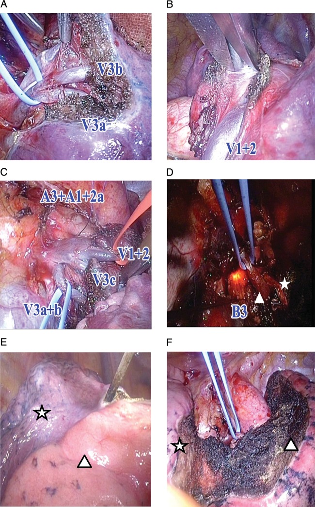 Figure 2: