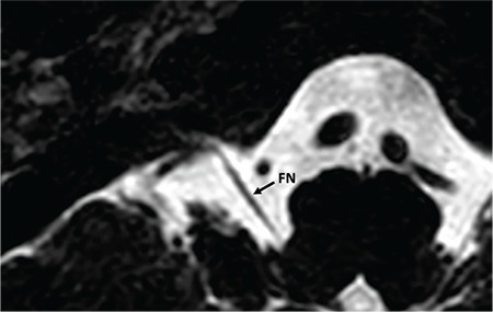 FIG. 9l.