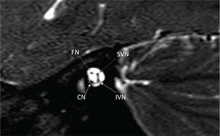 FIG. 9e.