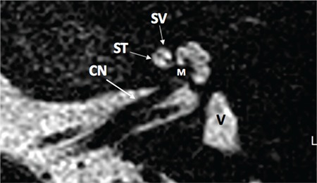 FIG. 1c.