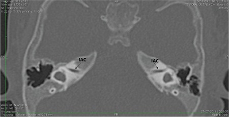 FIG. 9c.