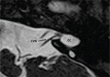 FIG. 9j.