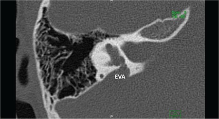 FIG. 7c.