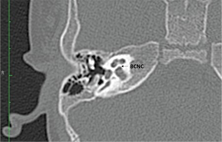 FIG. 9b.