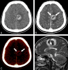 Fig 6.