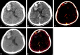Fig 2.