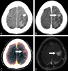 Fig 4.