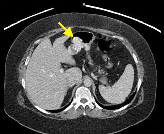 Figure 1: