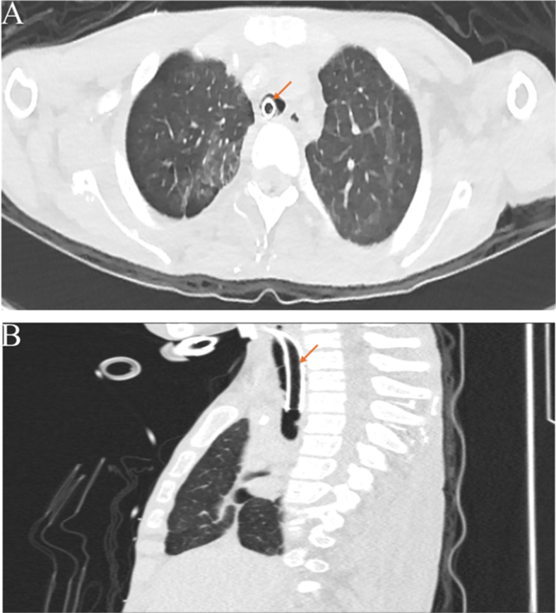 Fig. 5