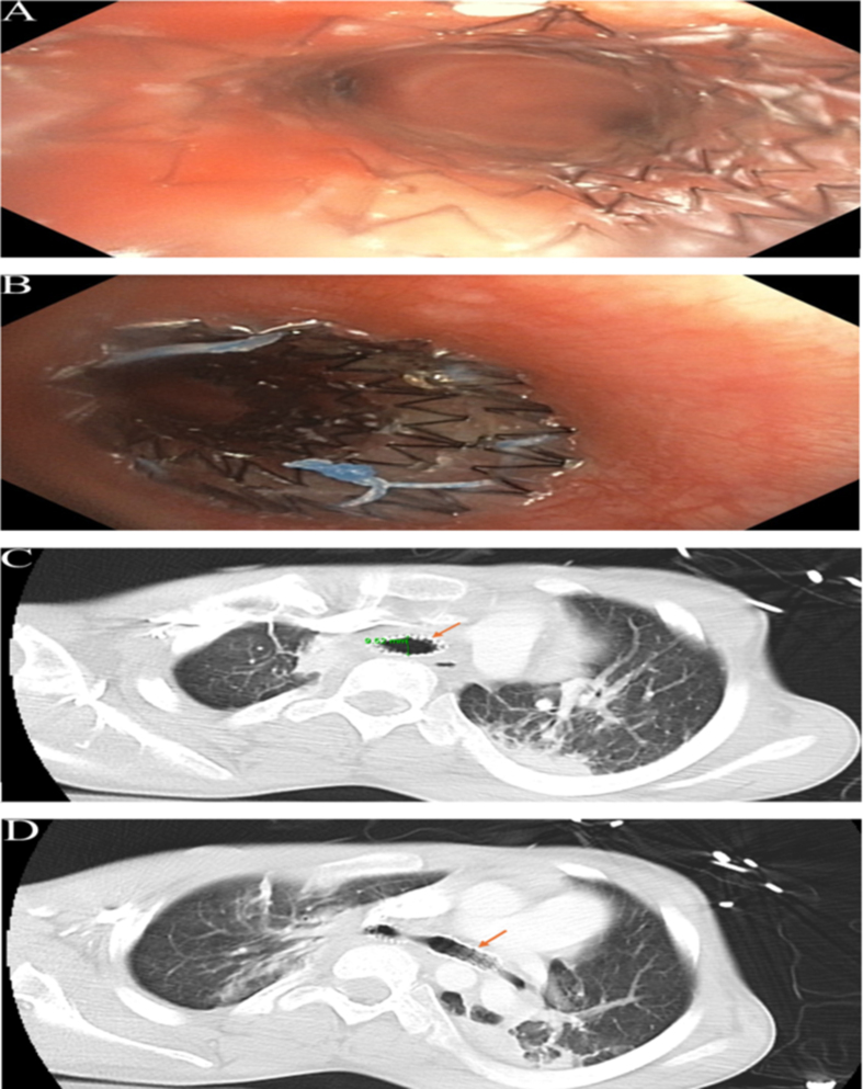 Fig. 4