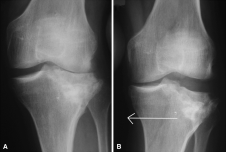 Fig. 1A–B