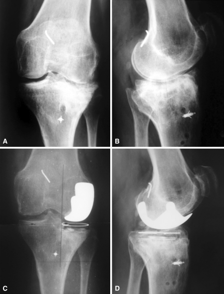 Fig. 3A–D