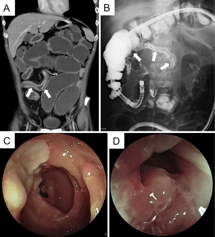 Figure 3.