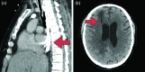 Fig 2.