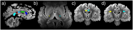 Fig. 12