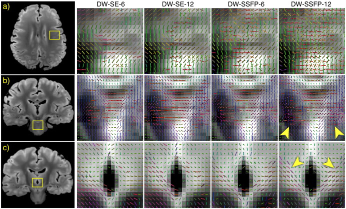 Fig. 11