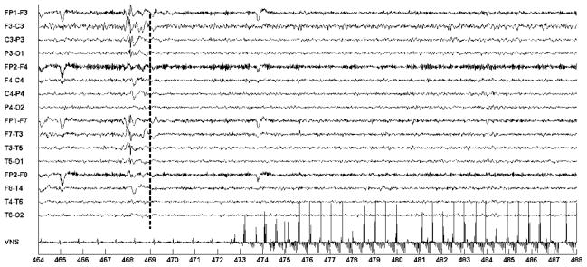 Fig. 14