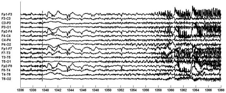 Fig. 10