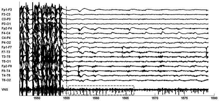 Fig. 12