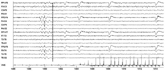 Fig. 15