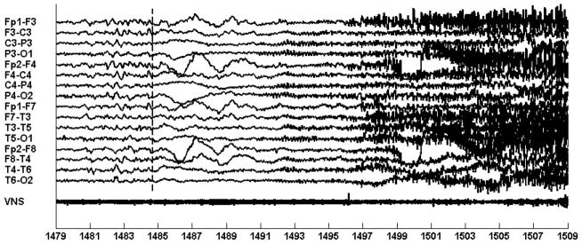 Fig. 11