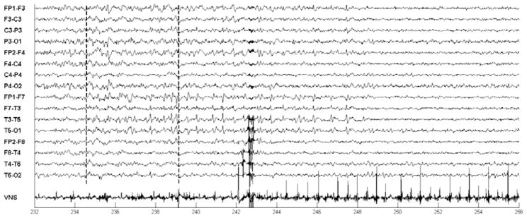 Fig. 13