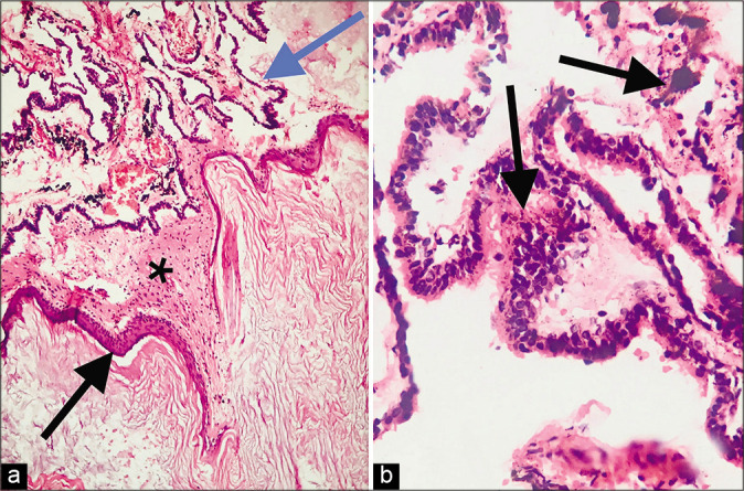 Figure 2: