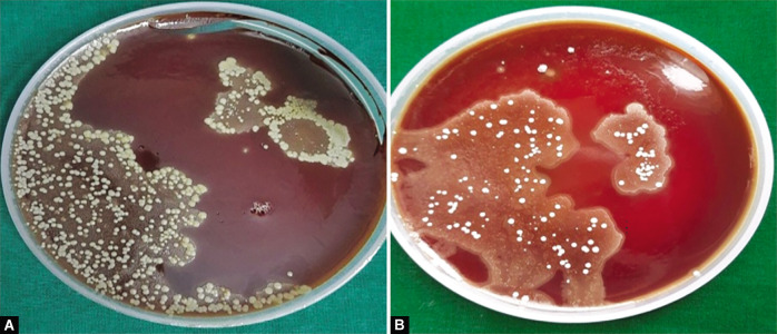 Figs 1A and B