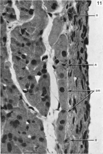 Fig. 11