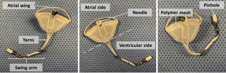 Figure 1