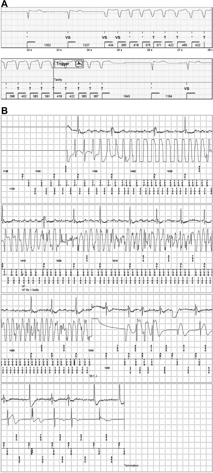 Figure 4