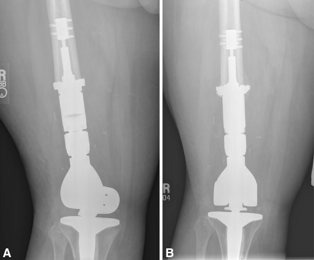 Fig. 2A–B