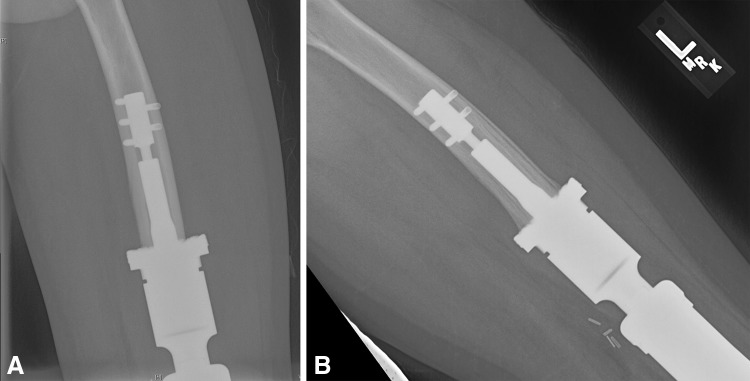 Fig. 1A–B