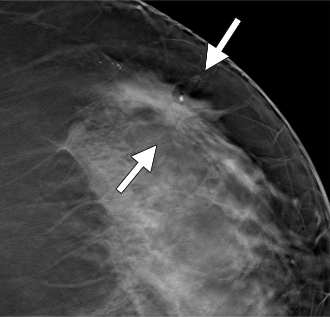 Figure 3b: