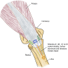 Fig 14