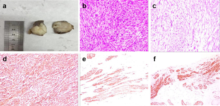 Figure 3