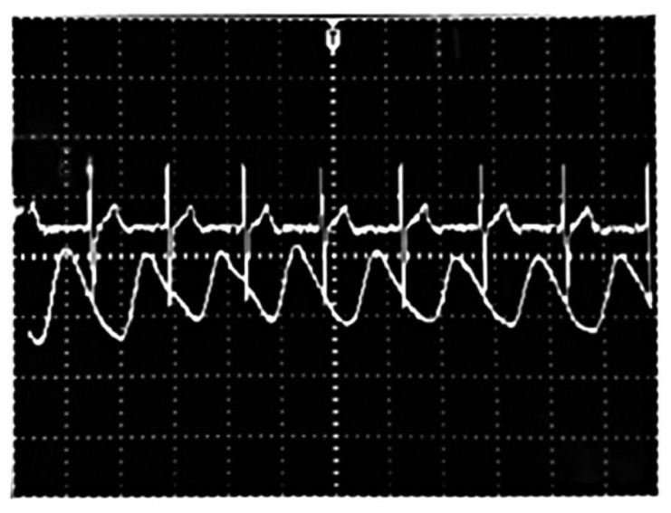 Figure 11.