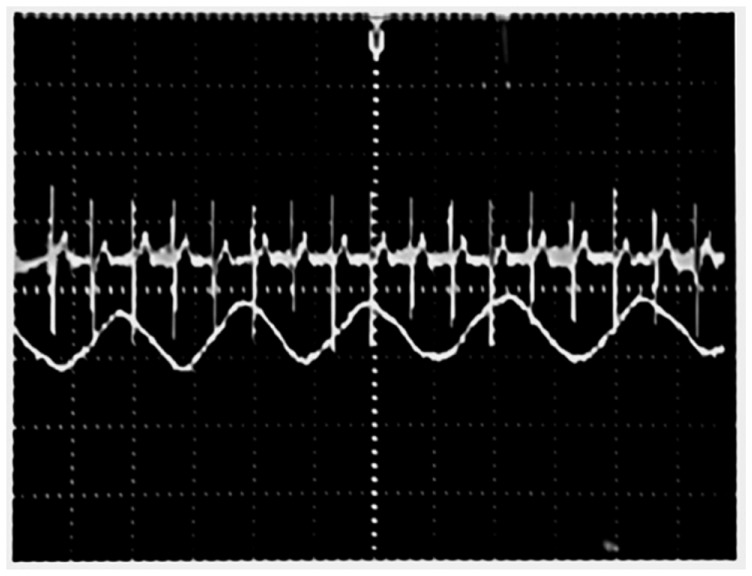 Figure 10.