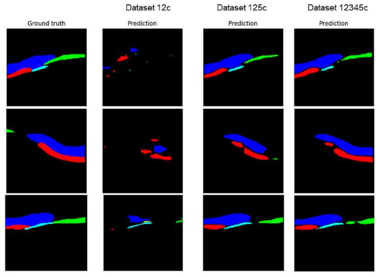 Figure 14