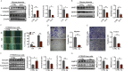 Figure 1A is a set of one western blot and three bar graphs. The western blot displays two columns, namely, control and arsenic-H for mouse placenta and four rows, namely, E-cadherin, Vimentin, N-cadherin, lowercase beta actin. The three bar graph plots E-cadherin per lowercase beta actin, ranging from 0 to 4 in unit increments; Vimentin per lowercase beta actin, ranging from 0.0 to 1.5 in increments of 0.5; N-cadherin per lowercase beta actin, ranging from 0.0 to 1.5 in increments of 0.5 (y-axis) across control and arsenic-H (x-axis). Figure 1B is a set of one western blot and two western blots. The western blot displays two columns, namely, control and arsenic-H for mouse placenta and three rows, namely, matrix metalloproteinases 2, matrix metalloproteinases 9, and lowercase beta actin. The two bar graphs plots matrix metalloproteinases 2 per lowercase beta actin, ranging from 0.0 to 1.5 in increments of 0.5 and matrix metalloproteinases 9 per lowercase beta actin, ranging from 0.0 to 15 in increments of 0.5 (y-axis) across control and arsenic-H (x-axis). Figure 1C is a set of one stained tissue and one bar graph. The stained tissue displays two columns, namely, control and arsenic for H T R 8 per SVneo cells and three rows, namely, 0 hour, 12 hours, 24 hours. The bar graph plots percentage of wound closing, ranging from 0 to 100 in increments of 20 (y-axis) across hours, ranging from 12 to 24 in increments of 12 (x-axis) for control and arsenic. Figure 1D is a set of one stained tissue and one bar graph. The stained tissue displays two rows, namely, control and arsenic for H T R 8 per SVneo cells. The bar graph plots relative O D, ranging from 0.0 to 1.5 in increments of 0.5 (y-axis) across control and arsenic (x-axis) for migration. Figure 1E is a set of one stained tissue and one bar graph. The stained tissue displays two rows, namely, control and arsenic for H T R 8 per SVneo cells. The bar graph plots relative O D, ranging from 0.0 to 1.5 in increments of 0.5 (y-axis) across control and arsenic (x-axis) for invasion. Figure 1F is a set of one western blot and three bar graphs. The western blot displays two columns, namely, control and arsenic for H T R 8 per SVneo cells and four rows, namely, Occludin, Vimentin, N-cadherin, lowercase beta actin. The three bar graphs plot Occludin per lowercase beta actin, ranging from 0 to 3 in unit increments; Vimentin per lowercase beta actin, ranging from 0.0 to 1.5 in increments of 0.5; N-cadherin per lowercase beta actin, ranging from 0.0 to 1.5 in increments of 0.5 (y-axis) across control and arsenic (x-axis). Figure 1G is a set of one western blot and two western blots. The western blot displays two columns, namely, control and arsenic for H T R 8 per SVneo cells and three rows, namely, matrix metalloproteinases 2, matrix metalloproteinases 9, and lowercase beta actin. The two bar graphs plots matrix metalloproteinases 2 per lowercase beta actin, ranging from 0.0 to 1.5 in increments of 0.5 and matrix metalloproteinases 9 per lowercase beta actin, ranging from 0.0 to 15 in increments of 0.5 (y-axis) across control and arsenic (x-axis).