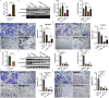 Figures 3A and 3E are bar graphs, plotting relative cysteine-rich angiogenic inducer 61 messenger ribonucleic acid, ranging from 0 to 8 in increments of 2 and 0.0 to 1.5 in increments of 0.5 (y-axis) across control and cysteine-rich angiogenic inducer 61 overexpression, and control and shCyr 61 (x-axis). Figure 3B is set of one western blot and two bar graphs. The western blot displays four columns, namely, control, cysteine-rich angiogenic inducer overexpression, arsenic, cysteine-rich angiogenic inducer overexpression plus arsenic, and three rows, namely, vimentin, N-cadherin, and lowercase beta actin. The two bar graphs, plotting Vimentin per lowercase beta actin, ranging from 0.0 to 2.0 in increments of 0.5 and N-cadherin per lowercase beta actin, ranging from 0.0 to 2.0 in increments of 0.5 (y-axis) across control, cysteine-rich angiogenic inducer overexpression, arsenic, cysteine-rich angiogenic inducer overexpression plus arsenic (x-axis). Figures 3C and 3D are set of one stained tissue and one bar graph. The stained tissue displays cell migration and cell invasion in control, cysteine-rich angiogenic inducer overexpression, arsenic, cysteine-rich angiogenic inducer overexpression plus arsenic. The bar graphs plot relative O D, ranging from 0.0 to 15 in increments of 0.5 (y-axis) across control, cysteine-rich angiogenic inducer overexpression, arsenic, and cysteine-rich angiogenic inducer overexpression plus arsenic (x-axis) for migration and invasion. Figure 3F is a set of one western blot and two bar graphs. The western blot displays four columns, namely, control, shCyr 61, arsenic, shCyr 61 plus arsenic, and three rows, namely, vimentin, N-cadherin, and lowercase beta actin. The two bar graphs, plotting Vimentin per lowercase beta actin, ranging from 0.0 to 1.5 in increments of 0.5 and N-cadherin per lowercase beta actin, ranging from 0.0 to 1.5 in increments of 0.5 (y-axis) across control, shCyr 6, arsenic, and shCyr 6 plus arsenic (x-axis). Figures 3G and 3H are set of one stained tissue and one bar graph. The stained tissue displays cell migration and cell invasion in control, shCyr 61, arsenic, shCyr 61 plus arsenic. The bar graphs plot relative O D, ranging from 0.0 to 15 in increments of 0.5 (y-axis) across control, shCyr 61, arsenic, and shCyr 61 plus arsenic (x-axis) for migration and invasion.