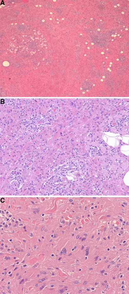 Fig. 1