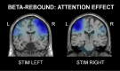 Figure 14.