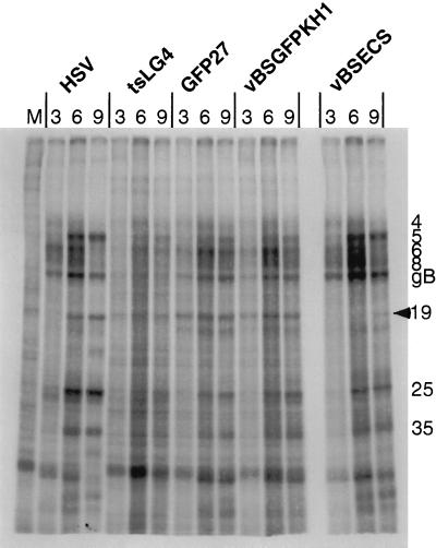 FIG. 5