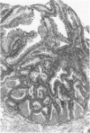 256