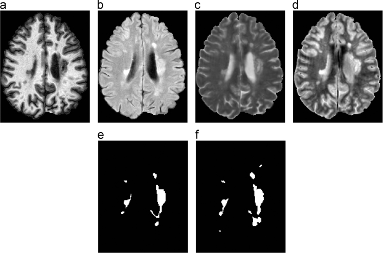 Fig. 1: