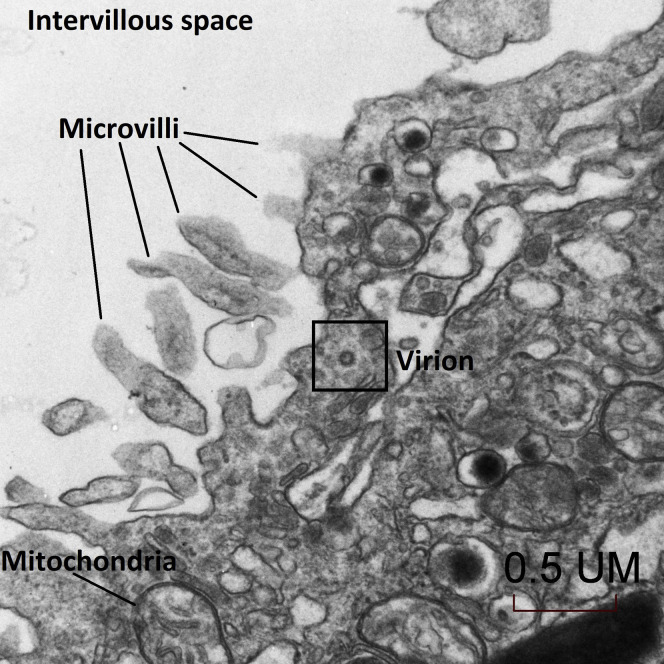 Figure 2