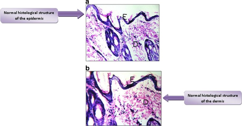 Fig. 11